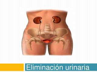 Eliminación urinaria