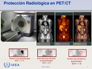 Protección Radiológica en PET/CT