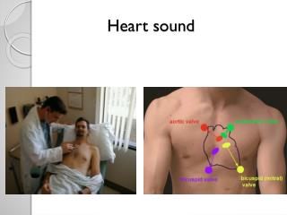 Heart sound
