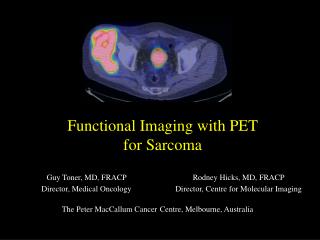 Functional Imaging with PET for Sarcoma