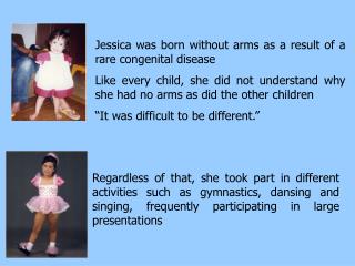 Jessica was born without arms as a result of a rare congenital disease