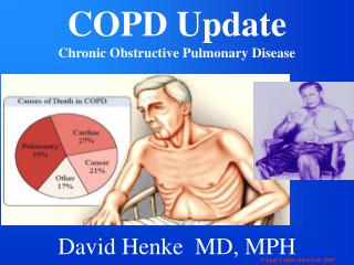 COPD Update Chronic Obstructive Pulmonary Disease