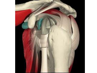 Which of the muscles visible in this figure would you label as an extrinsic back muscle?