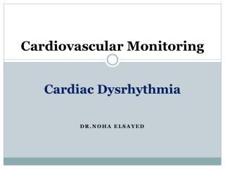 Cardiovascular Monitoring Cardiac Dysrhythmia