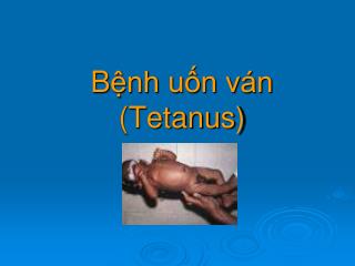 B ệnh uốn ván (Tetanus)