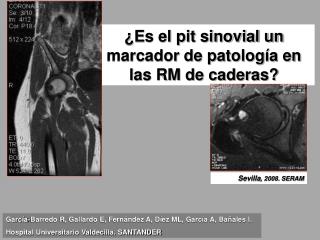 ¿Es el pit sinovial un marcador de patología en las RM de caderas?