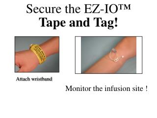 Secure the EZ-IO ™ Tape and Tag!