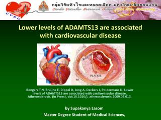 Lower levels of ADAMTS13 are associated with cardiovascular disease