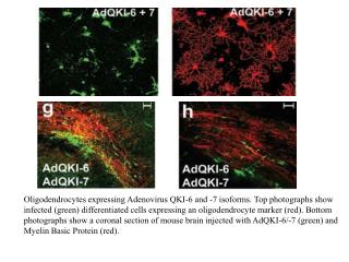 Oligodendrocytes expressing Adenovirus QKI-6 and -7 isoforms. Top photographs show