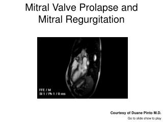 Mitral Valve Prolapse and Mitral Regurgitation