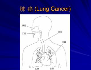肺 癌 (Lung Cancer)