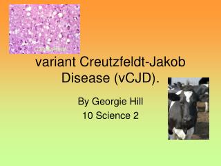 variant Creutzfeldt-Jakob Disease (vCJD).