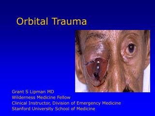 Orbital Trauma
