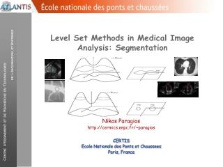 Level Set Methods in Medical Image Analysis: Segmentation