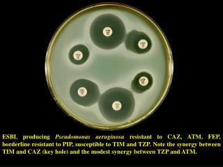Plasmid mediated ESBL in Pseudomonas aeruginosa Group 2be (class A enzyme)