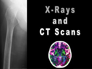 X-Rays and CT Scans