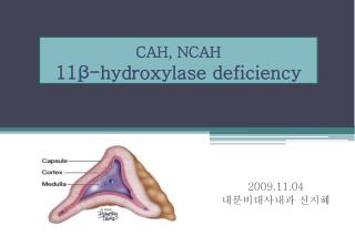CAH, NCAH 11β-hydroxylase deficiency