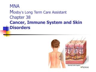 MNA M osby ’ s Long Term Care Assistant Chapter 38 Cancer, Immune System and Skin Disorders