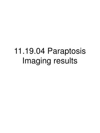 11.19.04 Paraptosis Imaging results