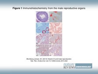 Figure 1 Immunohistochemistry from the male reproductive organs