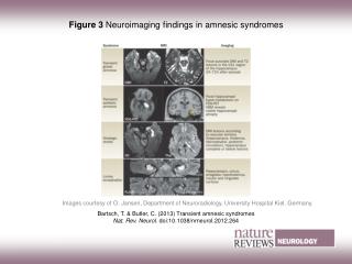 Figure 3 Neuroimaging findings in amnesic syndromes