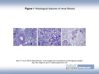 Figure 1 Histological features of renal fibrosis