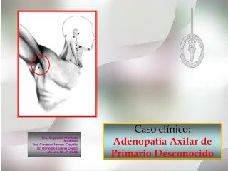 Caso clínico: Adenopatía Axilar de Primario Desconocido