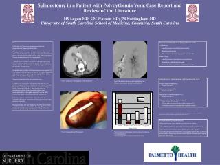 Splenectomy in a Patient with Polycythemia Vera: Case Report and Review of the Literature