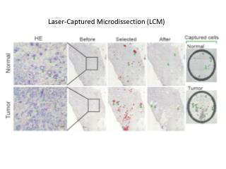 Laser-Captured Microdissection (LCM)