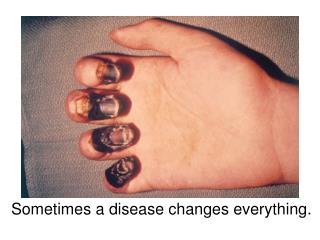 Sometimes a disease changes everything.
