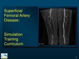 Superficial Femoral Artery Disease: Simulation Training Curriculum