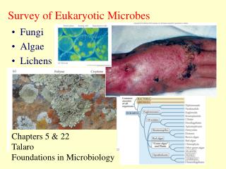 Survey of Eukaryotic Microbes