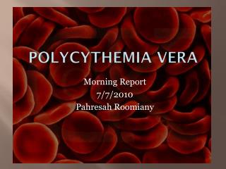 Polycythemia vera