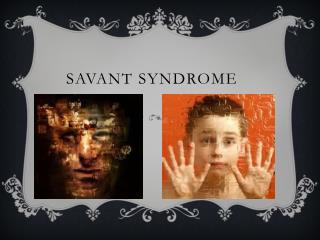 Savant Syndrome