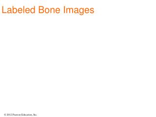 Labeled Bone Images