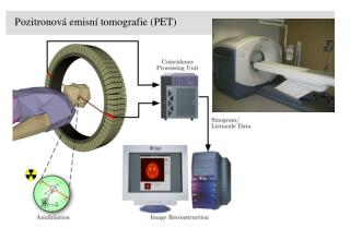 Pozitronová emisní tomografie (PET)