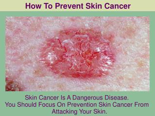 How To Prevent Skin Cancer