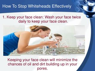 How To Stop Whiteheads Effectively