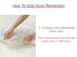 How To Stop Acne Reinfection