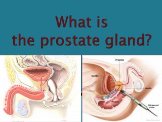 What is the prostate gland?