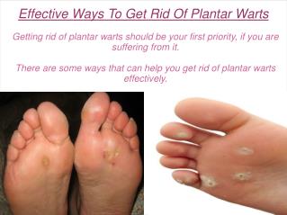 Effective Ways To Get Rid Of Plantar Warts
