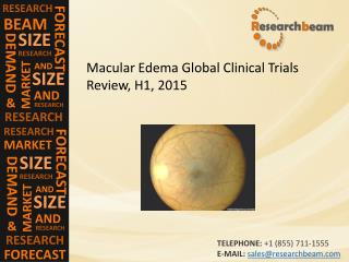 Macular Edema Global Clinical Trials Review, H1, 2015
