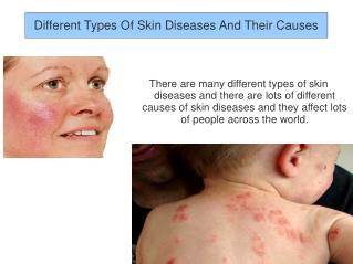 Different Types Of Skin Diseases And Their Causes