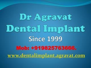 Dental Implants Ahmedabad India Affordable Best low costDent
