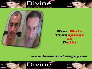 Fue Hair Transplantation Delhi