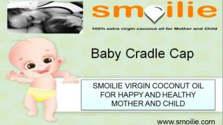 Baby Cradle Issues