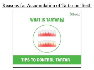 Reasons for Accumulation of Tartar on Teeth