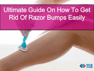 Ultimate Guide On How To Get Rid Of Razor Bumps Easily
