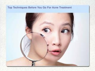 Top Techniques Before You Go For Acne Treatment
