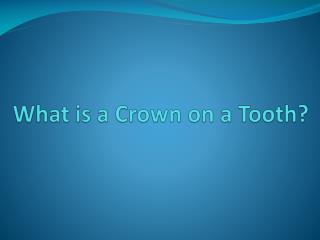 What is a Crown on a Tooth?